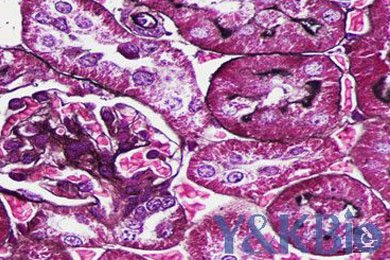 陕西六胺银染色