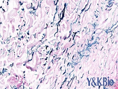 陕西维多利亚蓝染色