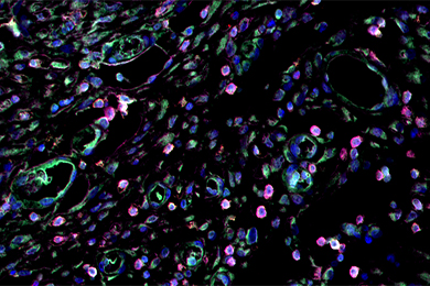 陕西普通切片（荧光三标 四色）扫描