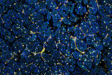 陕西普通切片（荧光四标 五色）扫描