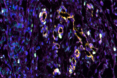 陕西普通切片（荧光五标