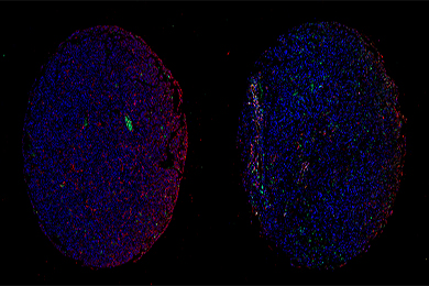 陕西组织芯片（荧光单标 双色）扫描