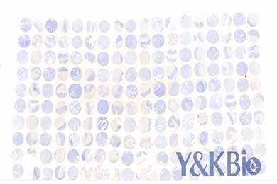 陕西白光芯片扫描