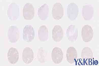 陕西组织芯片免疫组化染色