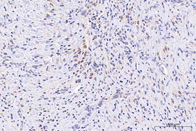 陕西Anti-iNOS Antibody