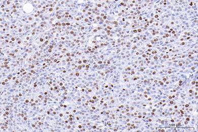 陕西Anti-Ki67 Antibody [SR00-02]