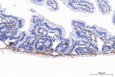 陕西Anti-MMP-2 Antibody [PSH11-26]