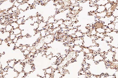 陕西NF-kB p65 Recombinant Rabbit Monoclonal Antibody [SZ10-04]