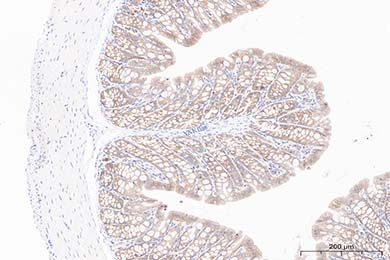 陕西Occludin Recombinant Rabbit Monoclonal Antibody [JJ091-08]